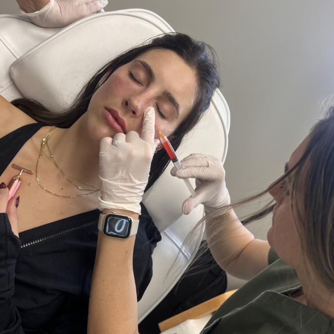 Bare Radiance October Blog Image PRF and PRF EZgel Treatments Westminster CO