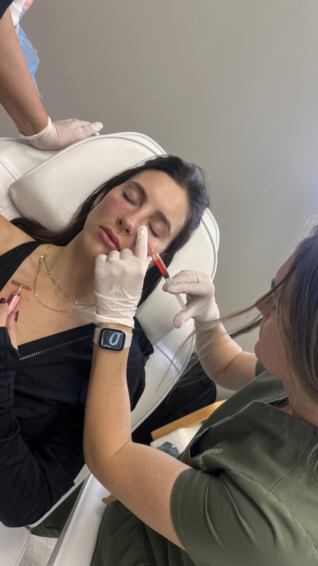 1st Blog PRF and PRF EZgel treatments in Westminster & Broomfield CO