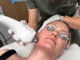 Moxi Laser treatment for all skin types in Westminster, CO