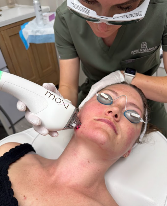 Moxi Laser treatment for all skin types in Westminster, CO