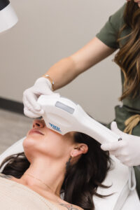 BBL HEROic laser treatment for pigmentation and anti-aging in Broomfield, CO