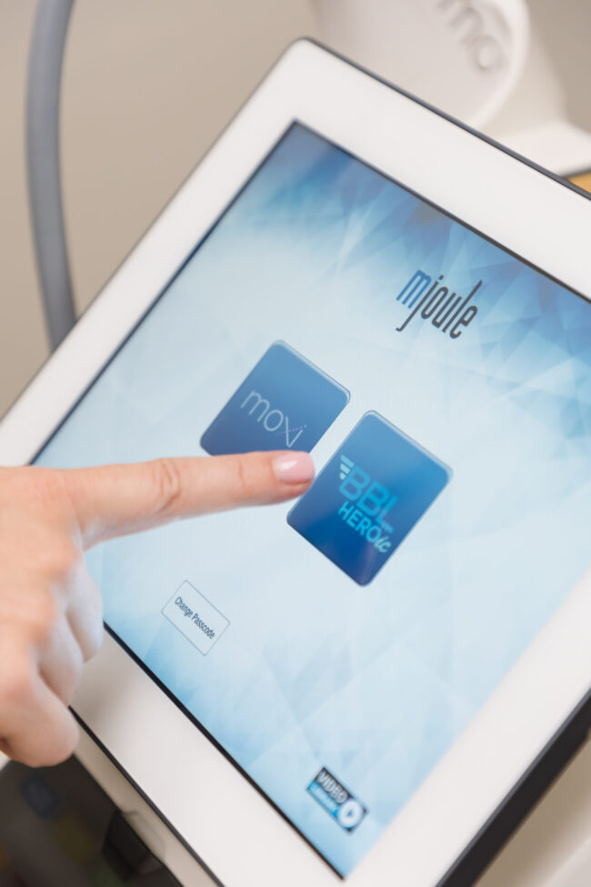 BBL & Moxi laser treatment at Bare Radiance in Westminster, CO.