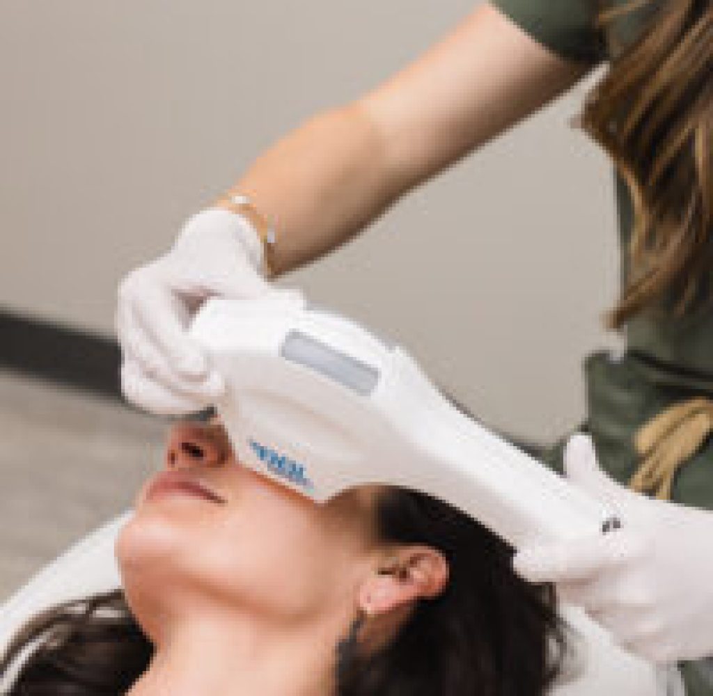 BBL HEROic BBL HEROic laser treatment for pigmentation and anti-aging in Broomfield, CO